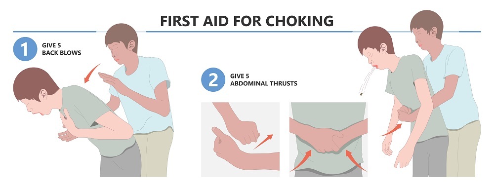 First Aid for Choking - Adult / Child