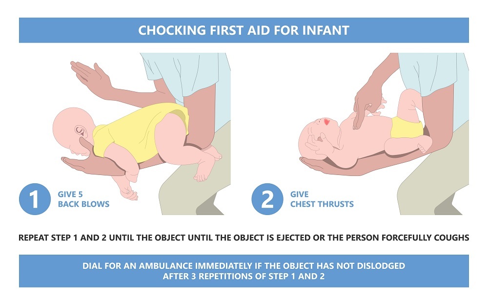 First Aid for Choking - Infant